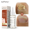 Repair Fungal Nail Essence Serum Care Repair Foot Nail Fungus Removal Gel Anti Infection Paronychia Onychomycosis Product
