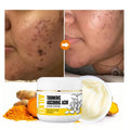 Private Label Shrink Pores Lightening Moisturising Turmeric Lotion Scar Removal Facial Acne Cream for African Skin