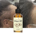 Private Label Natural Organic Nourishing Scalp Care Products Anti Hair Loss Serum Ginger Hair Growth Oil