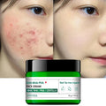 AHA BHA PHA Tea Tree Scar Removal Soothing Cream Whitening Face Skin Pimple Treatment Firming Moisturizing Cream