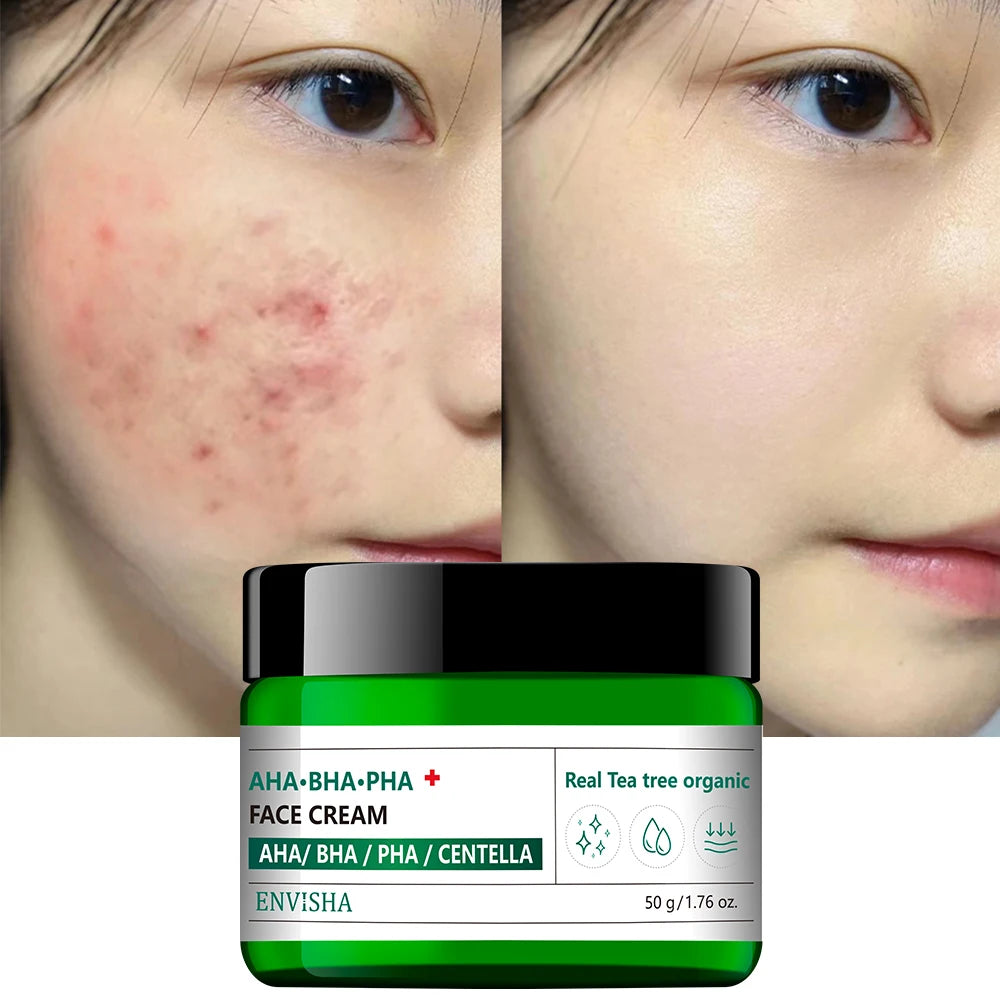 AHA BHA PHA Tea Tree Scar Removal Soothing Cream Whitening Face Skin Pimple Treatment Firming Moisturizing Cream