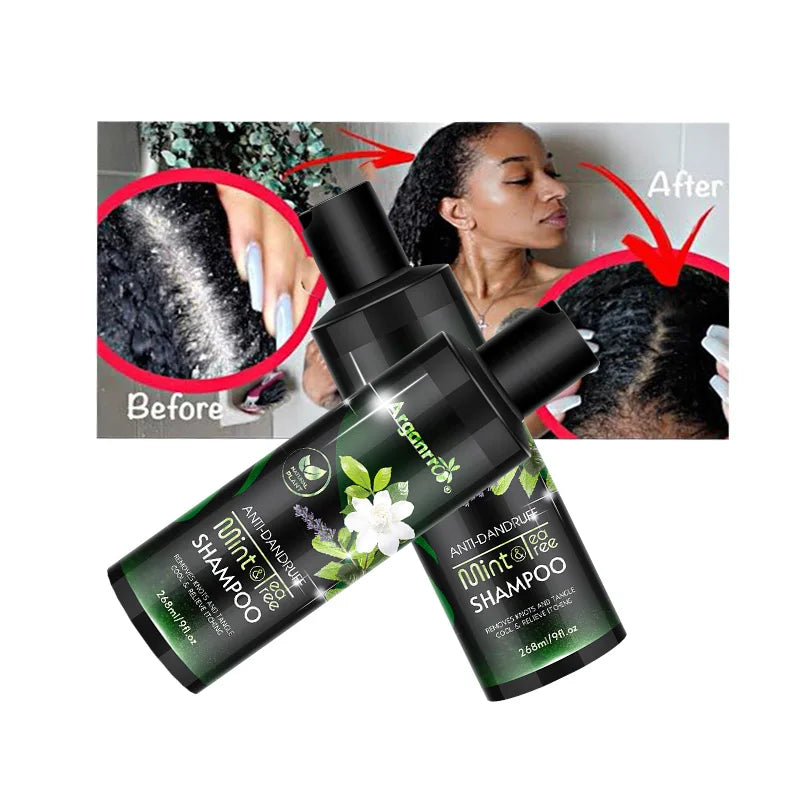 New Arrival Anti Dandruff Remover Anti Itch Relief Women Mint Rosemary Cool Mint Shampoo Organic