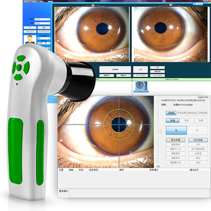 12MP Digital Body Health Analyzer Eye Iris Iridology Equipment with Iriscope Cameras