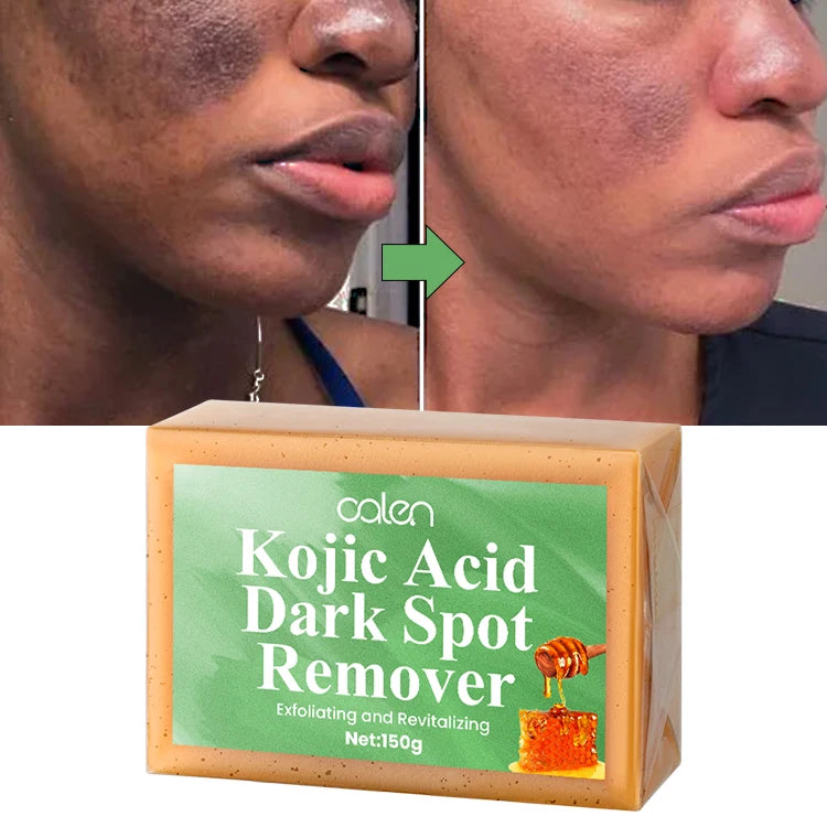 Luxfume 150g Private Label Skin Brightening Dark Spot Remover Turmeric Kojic Acid Soap