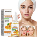 West Month Turmeric Anti Oxidation Face Serum Moisturizing Brightening Acne Marks Lightening Anti Wrinkle Facial Serum