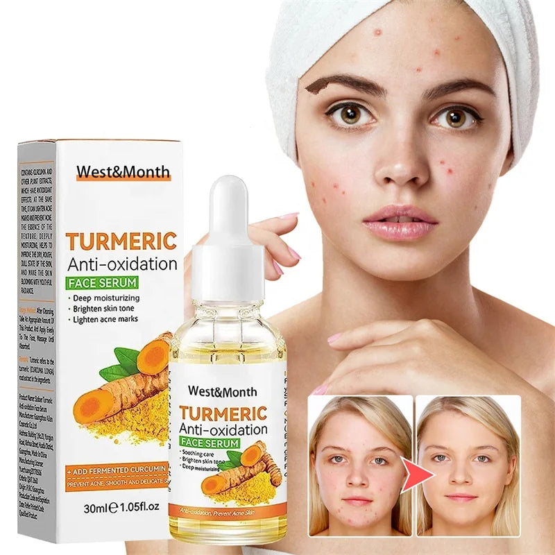 West Month Turmeric Anti Oxidation Face Serum Moisturizing Brightening Acne Marks Lightening Anti Wrinkle Facial Serum