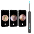 For R1 Smart Pro 3-in-1 Silicone Bar Endoscope 3.9mm Camera Ear Wax Remover Ear Cleaning Machine MegaBDM