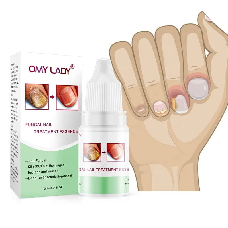 Good Result Infection Fighter Remedy for Damaged Aging Nails Anti Fungal Nail Repair Solution MegaBDM