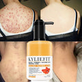 All Natural Vegan Herbal Lightening Whitening Control Oil Face & Body Lotion Acne Cream for Men Women