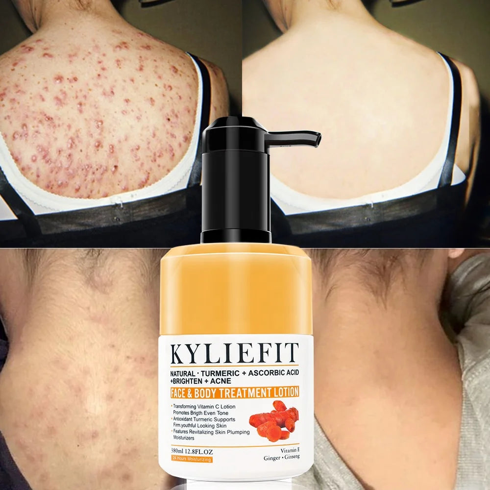 All Natural Vegan Herbal Lightening Whitening Control Oil Face & Body Lotion Acne Cream for Men Women