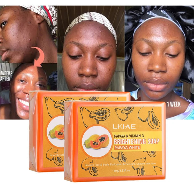 OEM ODM Private Label Super Whitening Savon Natural Kojic Acid Toilet Skin Brightening Face Body Papaya Soap for Light Skin Care