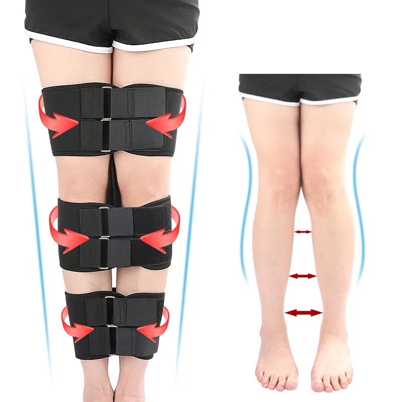 Leg Correction Belt Posture Corrector X/O Form Leg Correction Belt Bowleg Correct Band