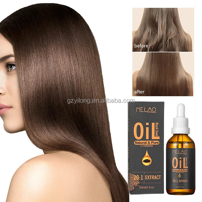 MELAO Natural 100% Pure Black Seed Oil Smoothing Hair Skin Facial Care Undiluted Cold Pressed Black Seed Oil for Hair and Skin