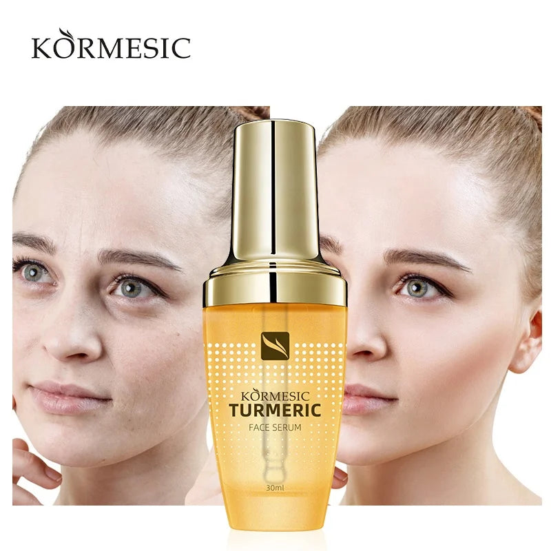 Face KORMESIC Whitening Skin Brightening Serum Turmeric Face Serum to Remove Dark Spot