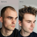 Male Replacement System Capilar Super 0406 0608 Thin Skin Silicone Base Knotted Pu Wigs Hair Patch