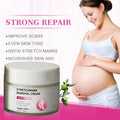 Customized logo Stretch Marks Remove Cream 100% Natural Anti-postpartum Deep Acne Scar Stretch Mark Removal Cream
