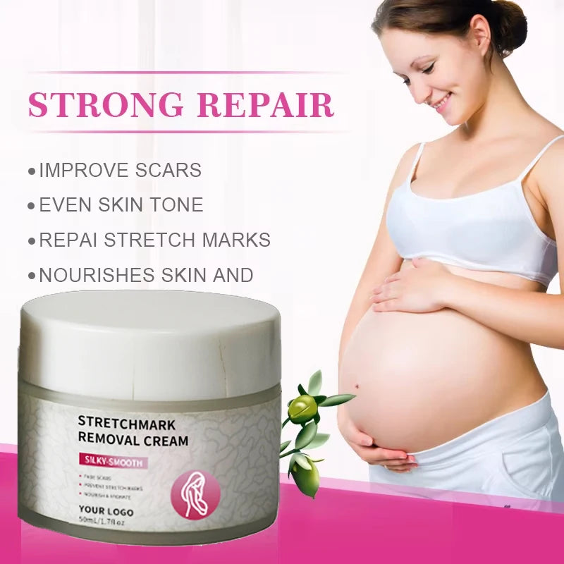 Customized logo Stretch Marks Remove Cream 100% Natural Anti-postpartum Deep Acne Scar Stretch Mark Removal Cream