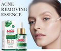 High Concentration Active Formula Multifunction Tea Tree Oil Anti-wrinkle Face Skin Serum