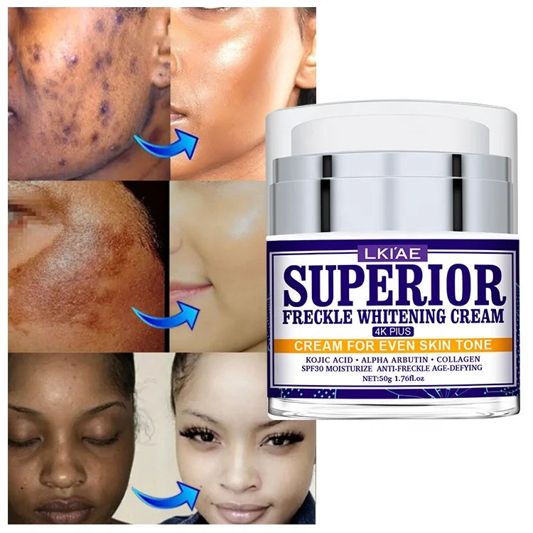 Alike Products Black Spot Spf30 Bleaching Lightening Korean Collagen Kojic Acid Face Whitening Cream for African Skin