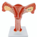 Normal Bilateral Ovarian Uterus Medical Teaching Education Model
