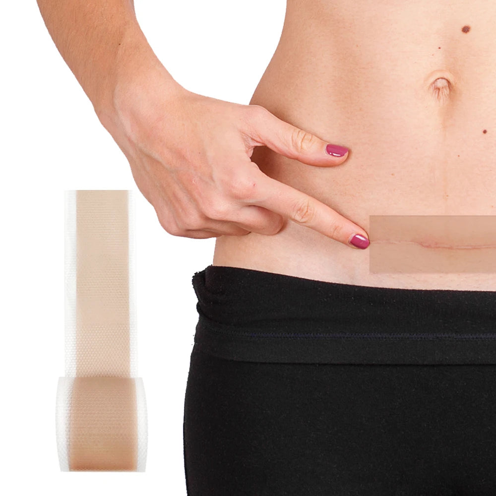 Beauty Care Products Silicone Tape Silicone Gel Patch Medical Grade Silicone Sheets for Scars Invisible
