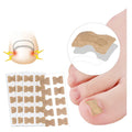 Ingrown Toenail Corrector Adhesive Sticker Pedicure Patch for Foot Care Manicure & Pedicure Set