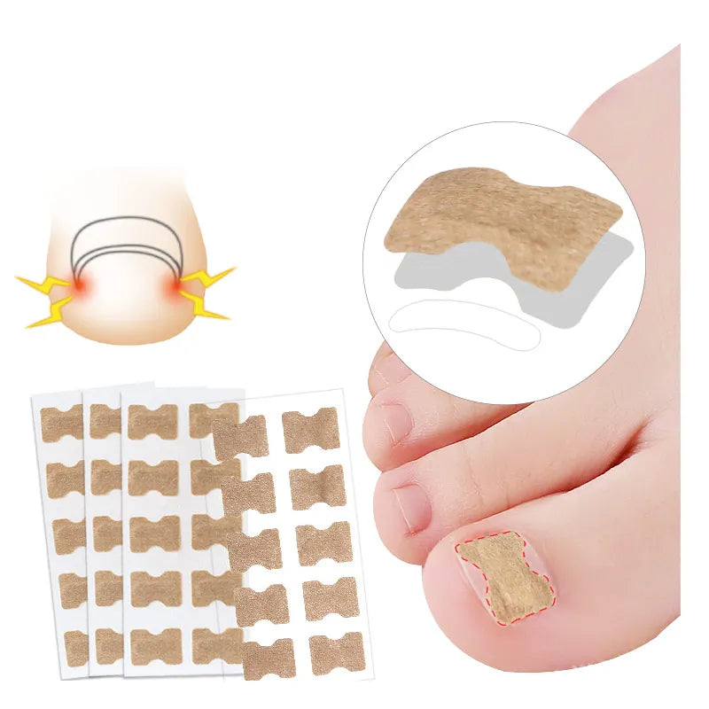 Ingrown Toenail Corrector Adhesive Sticker Pedicure Patch for Foot Care Manicure & Pedicure Set