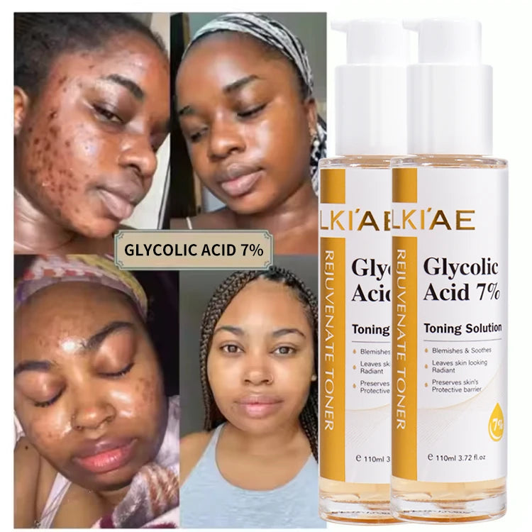 Hot Selling Face Toner Whitening Exfoliate Anti-Aging Hydrating Vitamin C Glycolic Acid 7% Skin Toners for Black Skin