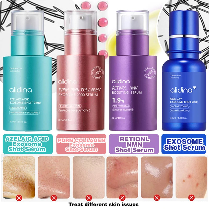 B AzA Exosame Shot Serum 7500 Deep Hydration for Smooth Even Skin Texture Use for After Spot Care with Niacinamide