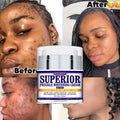 KYLIEFIT Anti Freckle Whitening Deep Moisturizing Removal Dark Spot Corrector Skin Anti Aging Remover Face Cream