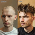 Wholesale D7-3 Custom Human Hair Fine Mono Natural Toupee Hair Replacement Pieces for Men