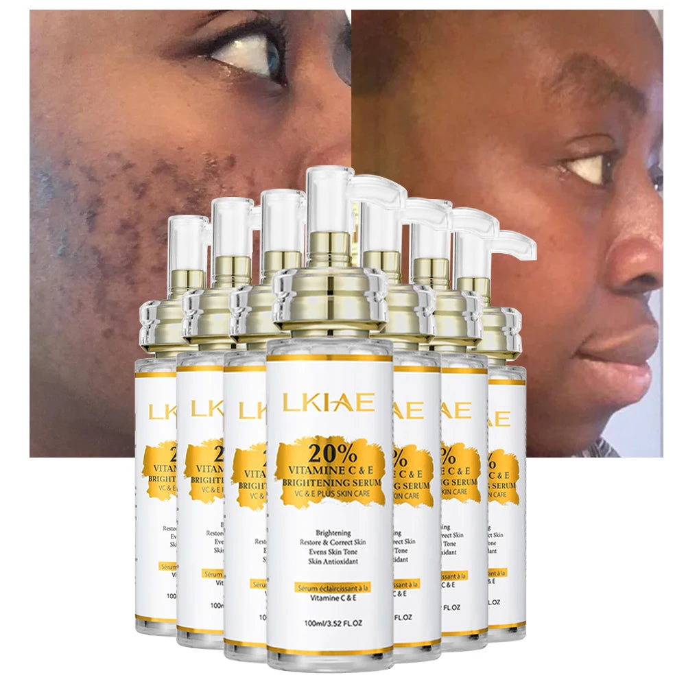 Private Label ODM Skin Care Serum Anti Aging Brightening Whitening Wrinkle Vit C Glowing Hyaluronic Acid B5 100ml for Face Body