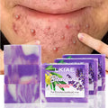Top Premium Kogic Acid Handmade Soap Cruelty-free Brightening Moisturizer with Hyaluronic Acid Lavender Body Soap for Black Skin MegaBDM