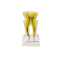 Multifunctional 6-Molar Tooth Model Nerve Anatomical for Dentist Education Demonstration Multifunctional Oral Hygiene Product