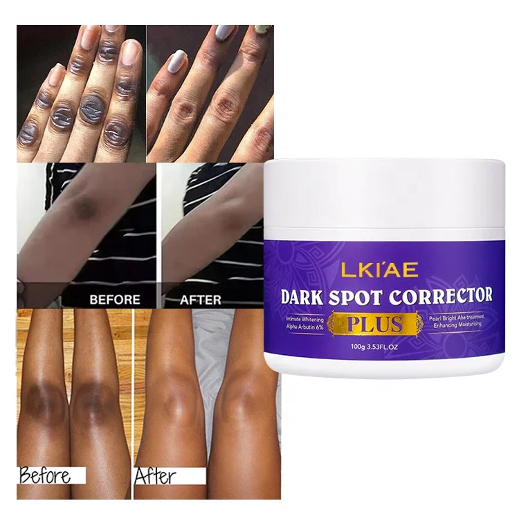 Private Label Natural Face and Body Pigmention Anti Melasma Removal Anti Aging Bleaching Knuckle Cream