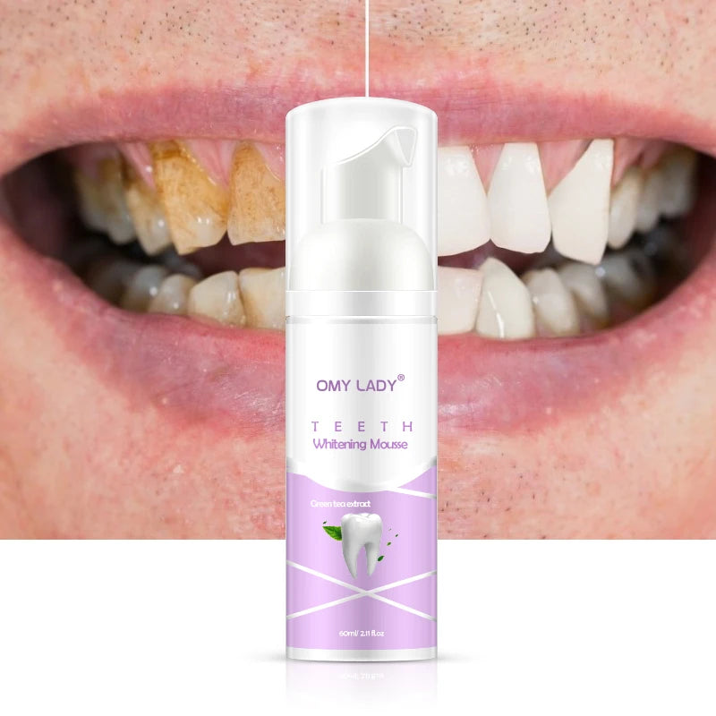Shining Tooth-Cleaning Mousse Toothpaste Teeth Whitening Oral Hygiene Removes Plaque Stains Bad Breath Dental Tool