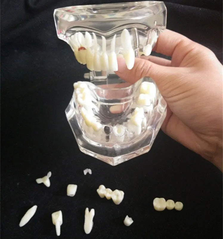 Removable Dental Pathological Model Teeth Small Size Resin + Crystal Material Multi-Purpose Teeth Whitening Accessory 50g