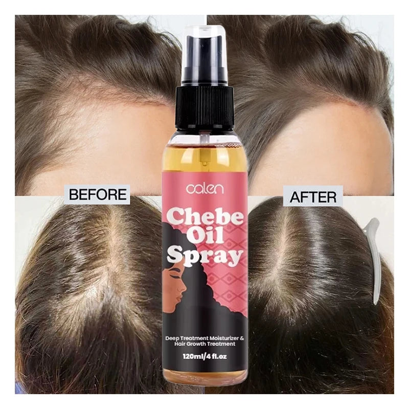 Luxfume 120ML Customized Daily Hair Scalp Nourishing Oil Moisturizing Anti-Dandruff & Refreshing Chebe Hair Growth Spray