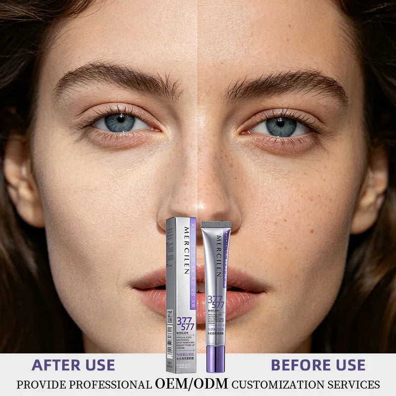 MERCILEN Whitening Spot-Removing Brightening Moisturizing Tone-Up Cream Dark Spot Black Skin Cream Facial Whitening Cream MegaBDM