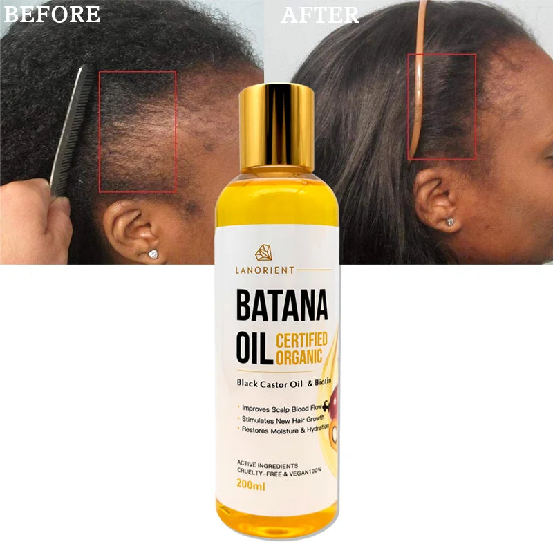 2026 Best-Selling Natural Organic Castor Batana Hair Growth Oil with 2-IN-1 Formula for Moisturizing Nourishing Refreshing Hair