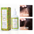 Customized Wholesale Anti Hair Loss Organic Repair Hair Treatment Extract Hair Growth Serum
