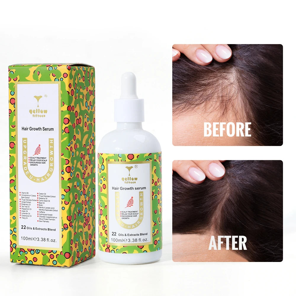 Customized Wholesale Anti Hair Loss Organic Repair Hair Treatment Extract Hair Growth Serum