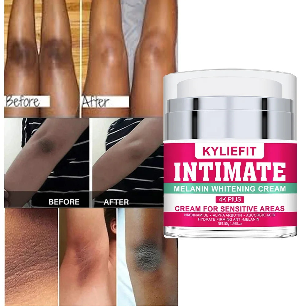 OEM ODM Private Label Extreme Whitening Anti Dark Spot Knees Elbows Strong White Lotion Face Body Whitening Cream