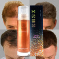 Custom Womens Men Top Forehead Rene System Spray Hair Replacement