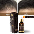 OTVENA Organic Hair Loss Fast Hair Growth Products Hair Growth Growth Oil