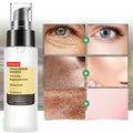 Hyaluronic Acid Spray Hydra Power Essence Moisturizing Brightening Face Serum Repairing Sensitive Skin Care Skin Care Serum