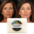 200g Natural Organic Skin Whitening Deep Cleansing and Exfoliating Niacinamide Coconut Whitening Soap for Glowing Skin
