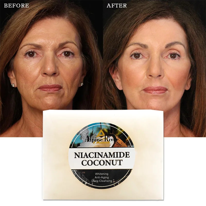 200g Natural Organic Skin Whitening Deep Cleansing and Exfoliating Niacinamide Coconut Whitening Soap for Glowing Skin
